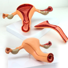 ANATOMY04 (12442) Estructura uterina Modelo anatómico, Anatomía Modelos&gt; Sistema reproductivo